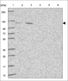 Anti-UBE3C Antibody