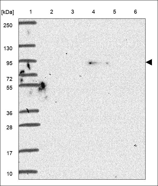 Anti-TRIM9 Antibody