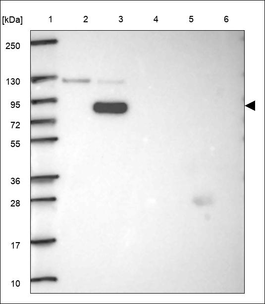 Anti-TBC1D10B Antibody