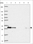 Anti-PAFAH1B2 Antibody