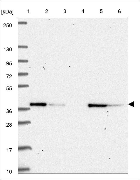 Anti-C9orf64 Antibody
