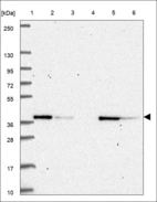 Anti-C9orf64 Antibody