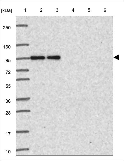 Anti-ECT2 Antibody