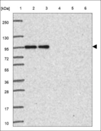 Anti-ECT2 Antibody