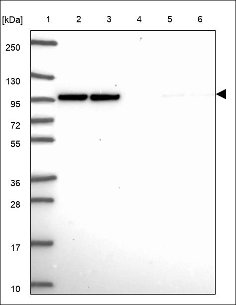 Anti-TMTC3 Antibody