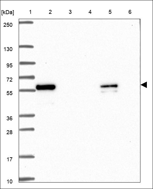 Anti-CEP83 Antibody