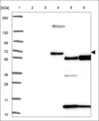 Anti-AMPD3 Antibody