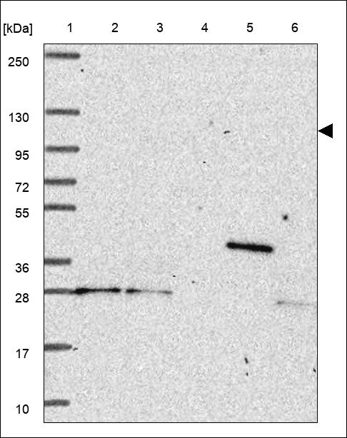 Anti-TCIRG1 Antibody