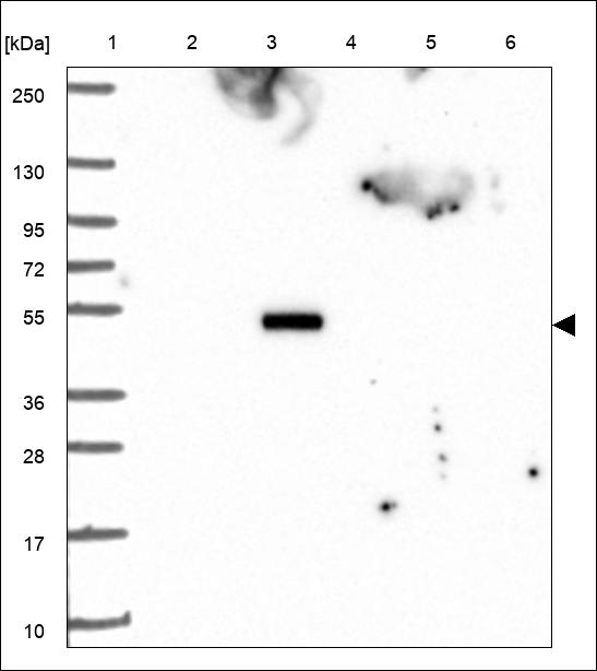 Anti-TFDP3 Antibody