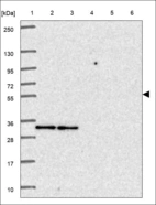 Anti-AP3M1 Antibody