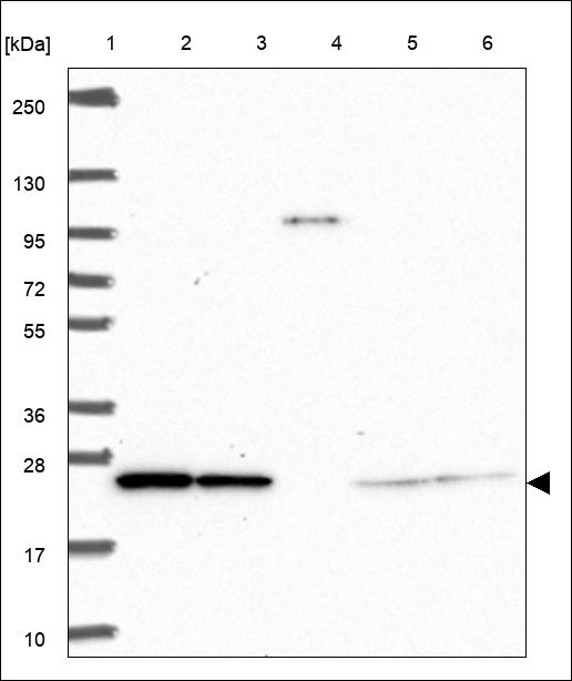 Anti-COMMD4 Antibody