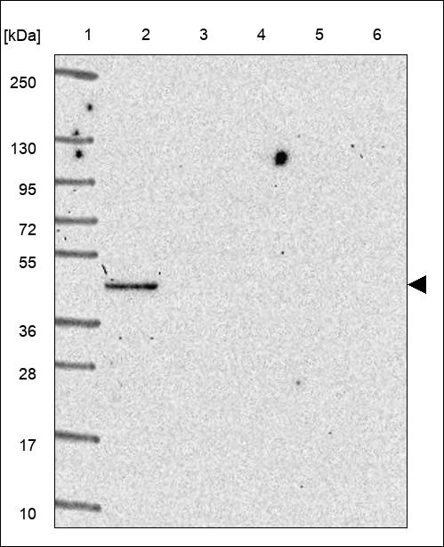 Anti-CYP4A11 Antibody