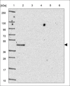 Anti-CYP4A11 Antibody