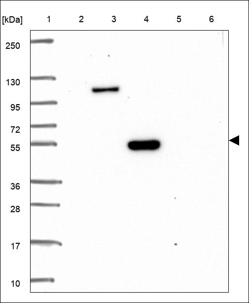 Anti-DNTT Antibody