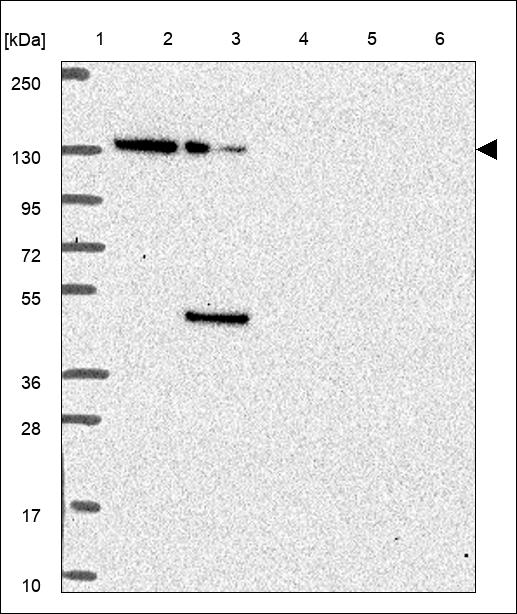 Anti-YTHDC2 Antibody