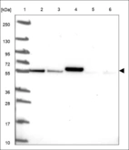 Anti-UBE2Q1 Antibody