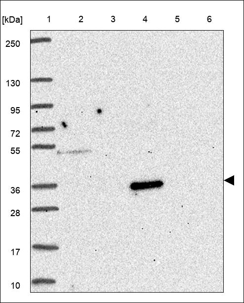 Anti-SERPINB12 Antibody