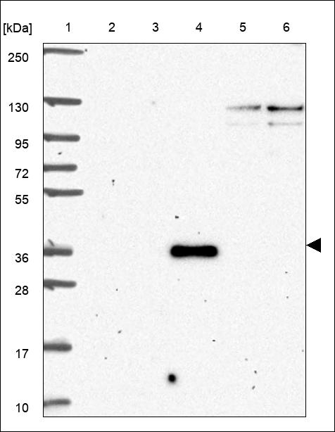 Anti-CSNK1G1 Antibody