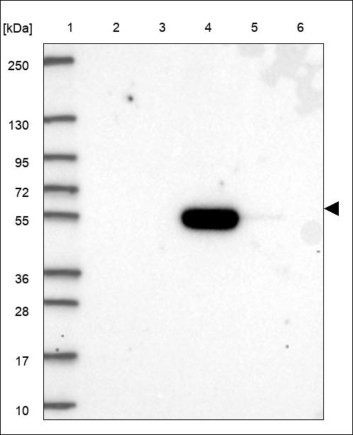 Anti-CDADC1 Antibody
