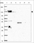 Anti-RPGRIP1L Antibody