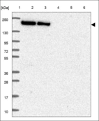 Anti-PPIP5K1 Antibody