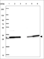 Anti-ANKRD54 Antibody