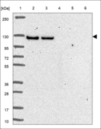 Anti-DIP2A Antibody