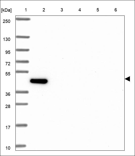 Anti-MEAK7 Antibody