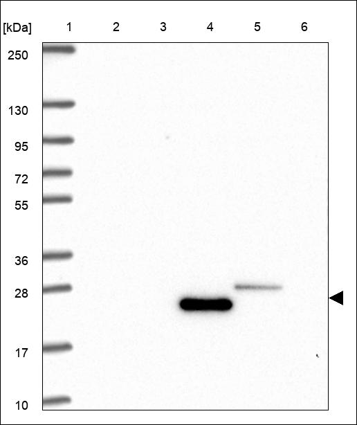 Anti-LDLRAD4 Antibody