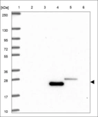 Anti-LDLRAD4 Antibody