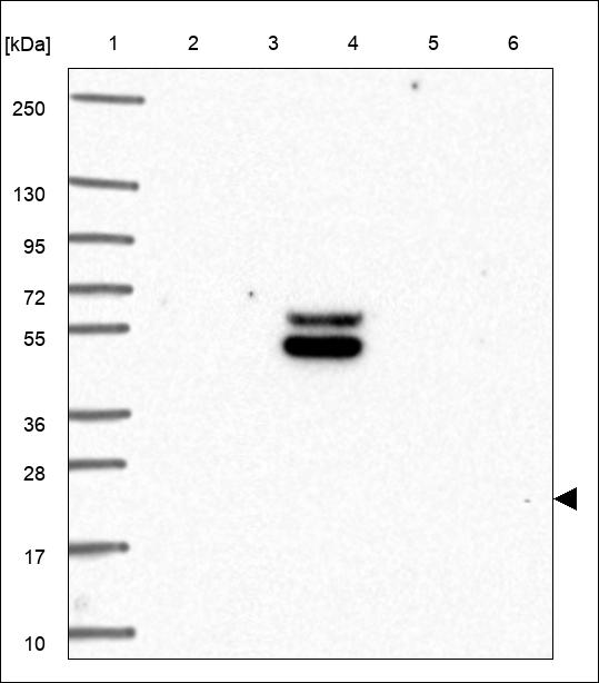 Anti-ADCYAP1 Antibody