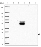 Anti-ADCYAP1 Antibody