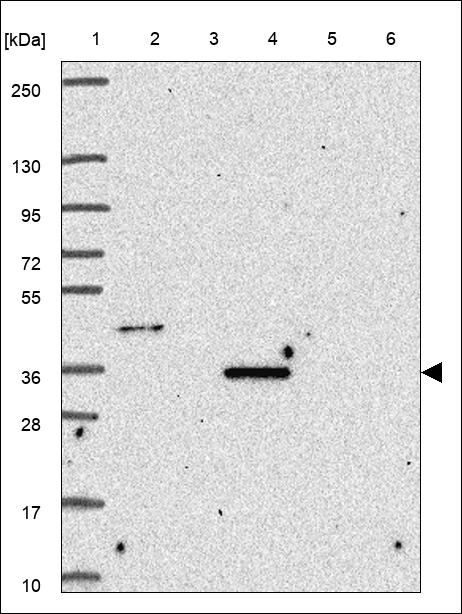 Anti-OPRL1 Antibody