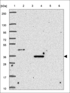 Anti-OPRL1 Antibody