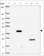 Anti-CSNK1A1 Antibody