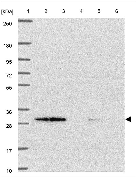 Anti-UBE2J2 Antibody