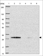 Anti-UBE2J2 Antibody