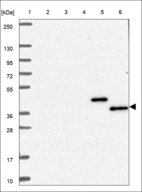 Anti-TERF1 Antibody