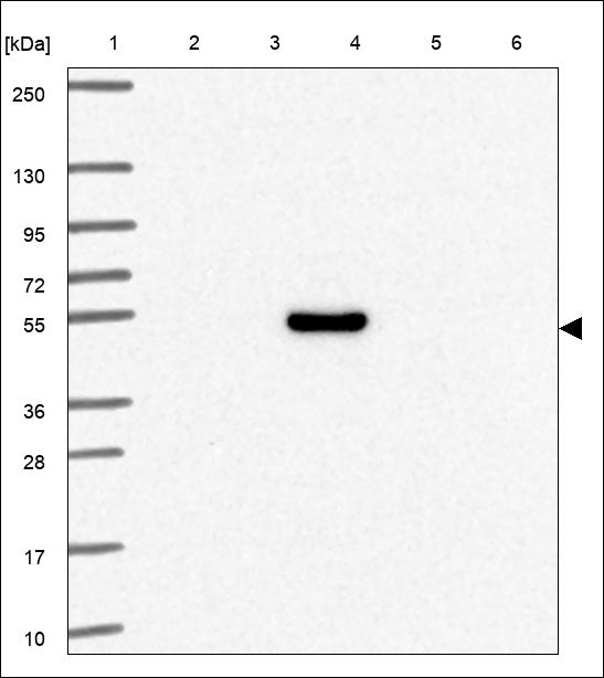 Anti-ERCC8 Antibody