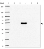 Anti-ERCC8 Antibody