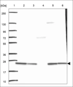 Anti-DHRS4L2 Antibody