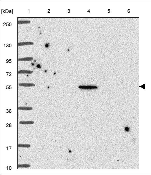 Anti-TRIM39 Antibody