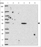 Anti-TRIM39 Antibody