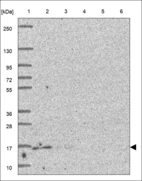 Anti-UBE2D3 Antibody
