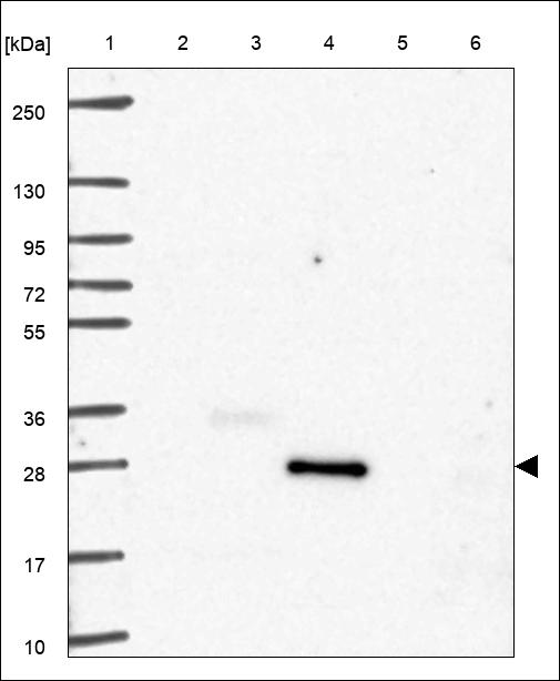 Anti-CRLS1 Antibody