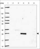 Anti-CRLS1 Antibody