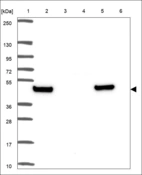 Anti-KLF10 Antibody