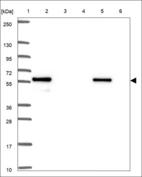 Anti-HIRIP3 Antibody