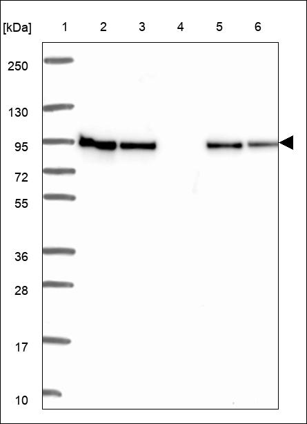 Anti-ANKRD27 Antibody