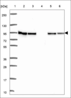 Anti-ANKRD27 Antibody